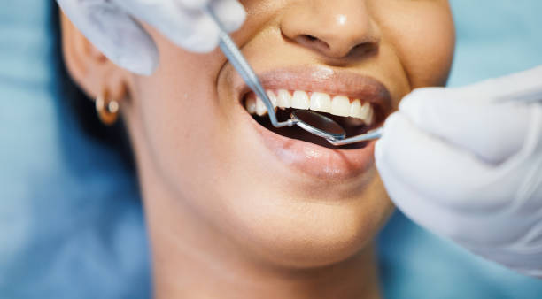 Best Emergency Dental Care for Broken or Chipped Teeth in Riverside, MD