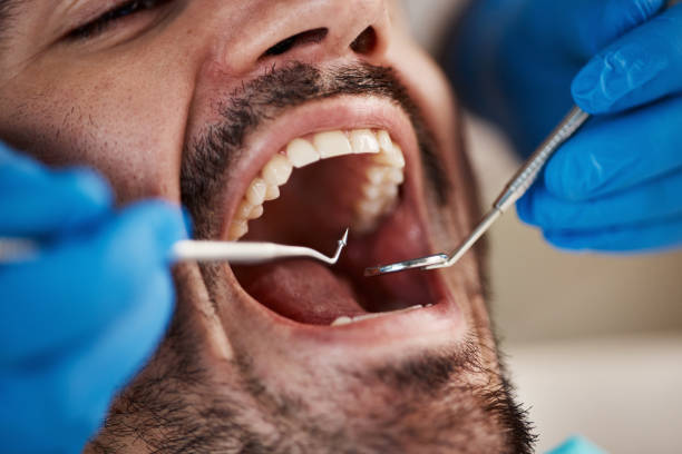 Best Emergency Treatment for Dental Infections or Abscesses in Riverside, MD